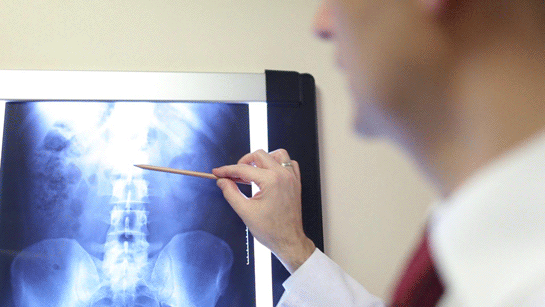 Fıtık Başlangıcı Belirtileri ve Tedavisi