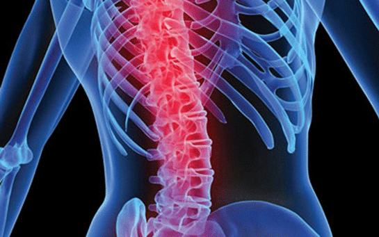 Fıtık Nedir? ve Nasıl Bir Hastalıktır