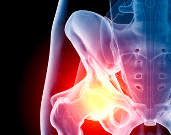 Kasık Fıtığı Belirtileri Nelerdir?